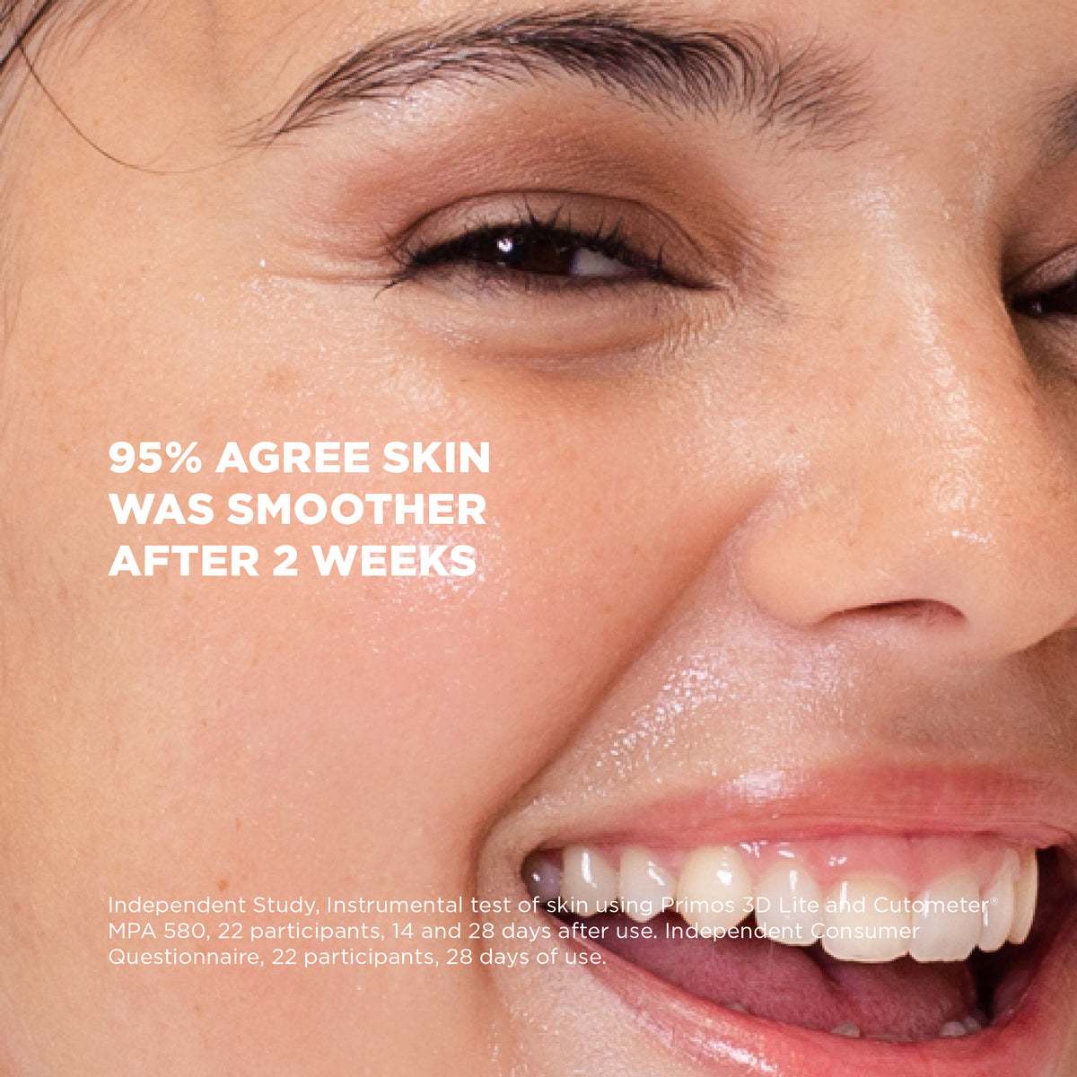 Retinoid Complex 1% Serum 30ml